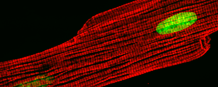 Picture of a cardiomyocyte with myosin fibers stained red and nuclei stained green.