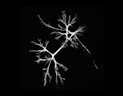 Alexandra Borelli/Mark Young (Anseth Lab) - Nikon A1R Laser Scanning Confocal. Mesenchymal stromal cells (MSCs) are a type of stem cell that can differentiate into a variety of cell types. Further, MSCs are able to influence almost all the components of the immune system and may play a role in both tumor growth and suppression. Investigating their abilities and function may help reveal new targets for cancer therapy. Here, a cluster of MSCs derived from bone-marrow are shown in white.