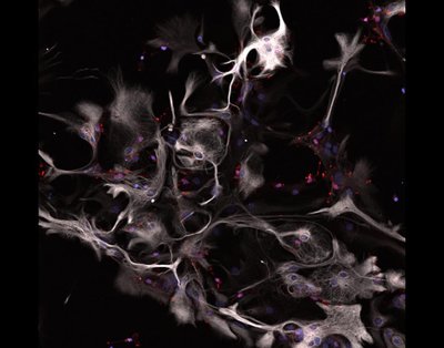 Andrew Lombardi (Hoeffer lab) - Nikon A1R Laser Scanning Confocal. Astrocytes are star-shaped cells found in our brain, supporting many essential functions, from roles in neuroprotection to memory. Here, we see the distribution of astrocytes (white), microglia (immune cells that protect the brain, red) and their nuclei (blue). Research has shown that diseased brains have a different architecture compared to healthy brains, and this may contribute to diminished function.