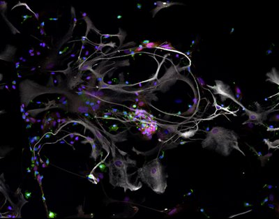 Andrew Lombardi/Jessica Hanson (Hoeffer Lab) - Nikon A1R Laser Scanning Confocal. Astrocytes are star-shaped cells found in our brain, supporting many essential functions to help maintain its appropriate operation. Here, the astrocytes (white) and their nuclei (red) are being observed to determine their response to nicotine, with nuclei of neighboring cells (blue) and microglia (green) also shown. This research will enable the discovery of drug targets to assist those battling nicotine addiction.
