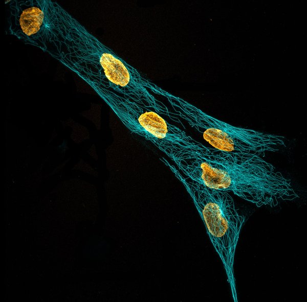 Human-derived stem cells embedded in a hydrogel (expansion microscopy). Taken by Varsha Rao and Arda Günay.