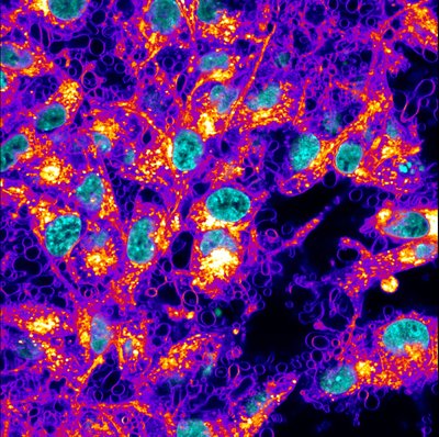Doug Chapnick (Liu Lab) - Nikon A1R. Researchers can effectively freeze living cells in their current position by the application of certain chemicals. This image here shows the continued movement of the cell membrane upon improper chemical treatment, highlighting the difficulty of preserving the cellular structure. The nuclei (in teal) remain structurally sound while the clarity of the membrane (violet to yellow) has been fully lost.