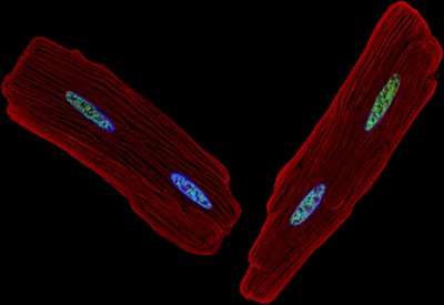 Christa Blenck (Leinwand Lab) - Nikon A1R. Here, the presence of estrogen (green) within the nucleus (blue) of an adult rat heart muscle cell (red) is shown. Estrogen has been shown to be a critical component in cardiac health and disease. Identification and further research of estrogen’s roll in maintaining cardiac health may lead to the development of treatments for a variety of cardiac diseases.