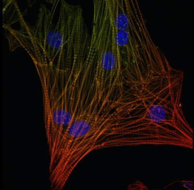 Esther Choi (Leinwand Lab) - Nikon A1R. Here, we see the heart muscle cells of a neonatal rat; its cellular components broken down and color-coded. The individual cellular units which allow for contraction and beating of the heart are shown in red, and the nuclei in blue. Images such as this help researchers in their quest to prevent or correct genetic heart defects.