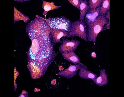 Mauricio Alvarez, Emma Worden-Sapper, Daniel Perez (Sawyer lab) - Nikon A1R Laser Scanning Confocal. The flu has been around for thousands of years, causing multiple pandemics that have resulted in millions of illnesses and deaths. Understanding how the virus can enter our cells, reproduce, and cause further infection is critical to developing novel therapeutics. Here, we infected cells (violet) with Influenza A virus, with the virus RNA genome visible in blue and white.