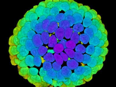 A1R-intestinalOrganoid