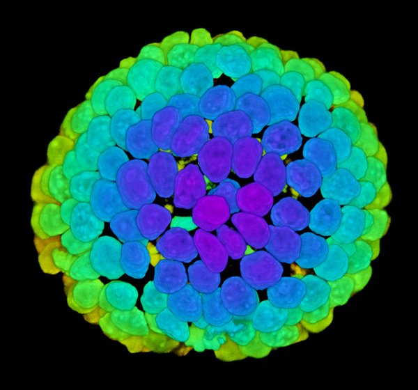 Intestinal organoid with color representing depth (blue is closer to observer, orange is further away). Taken by Max Yavitt.