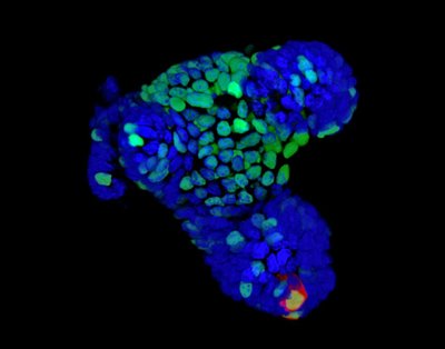 Logan Barrios, Jenna Stanislaw, Luis Paez Beltran, Carolina Valderrama Hincapie (IQ Biology PhD Program) - Nikon A1R Laser Scanning Confocal. Organoids are mini lab grown 3D tissues that mimic organs in the body and facilitate studies ranging from developmental processes to drug discovery. A benchmark of good quality organoids is the development of specialized cell types. Here we see an intestinal organoid which has developed crypt cells (shown in red), which are responsible for continually renewing the lining of the intestine. Nuclei of all cells are shown in blue and green. (Special thanks to Dr. Kaustav Bera, Anseth lab, for providing the sample.)