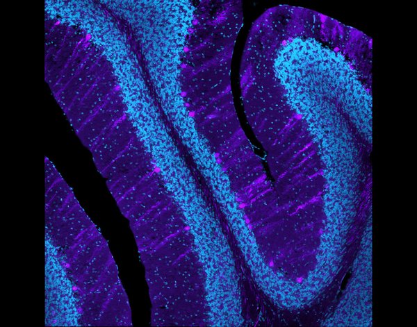 Cross section of a mouse cerebellum with specific ALS-associated proteins in purple and cell nuclei (blue). Taken by Jessica Hanson.