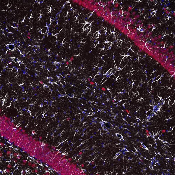 Hippocampus of a mouse. Glial cells (white), nuclei (blue), pre-neuronal cells (red). Taken by Luke Link.