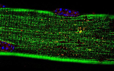 Evan Lester and Josh Wheeler (Parker Lab) - Nikon A1R. Messenger RNA (mRNA) is used within our cells to help create individual proteins that are needed for appropriate cellular function. Mislocalization of the mRNA can lead to the onset of various genetic diseases. Here, a muscle fiber (green) was isolated from the leg of a mouse and imaged to better understand the location of the mRNA (yellow and red) within the substructure of the muscle. The cell nuclei are shown in blue.