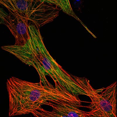 Esther Choi (Leinwand Lab) - Nikon A1R. Specific disease-inducing mutations can be studied on the molecular and cellular level through a viral expression system. Here, the individual sarcomere bundles of cardiac muscle cells (myocytes) are shown in red. Myocytes expressing the disease-causing protein (shown in green) can be distinguished from those that have not been infected. The nuclei are stained in blue.