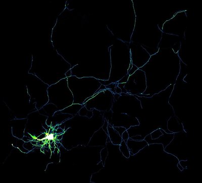 Lynn Sanford (Palmer Lab) - Nikon A1R. The hippocampus of the brain serves as the center for our emotions, memory, and the autonomic nervous system. Here, a hippocampal neuron has been genetically modified to report the local concentration of zinc, a tool that can provide insight into its function under normal and stressed conditions. In this image, the brighter colors indicate a higher zinc concentration. A deeper understanding of these functions can help medical professionals ensure the proper chemical balance within our neurons.