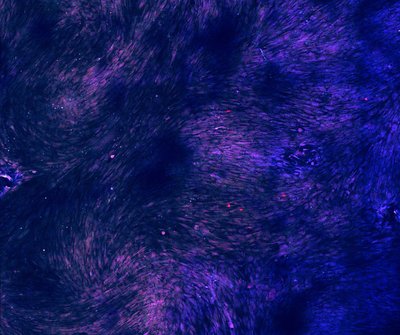 Maureen Bjerke (Leinwand Lab) - Nikon A1R. Stem cells have the amazing capability of essentially becoming any other cell type depending on their growth conditions. Larger structures, such as muscle fibers and organs, can also be formed from large fields of stem cells. Here, a field of stem cells (blue) with several pre-muscle cells (red) are growing together to be used for the controlled study of skeletal muscle diseases.
