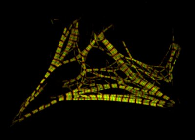 Chicca and Massimo Buvoli (Leinwand Lab) - Nikon A1R. Muscle fibers consist of repeating units of proteins called sarcomeres which, in this image, appear as alternating colored (red and green) and dark bands. Here, neonatal rat heart valve muscle cells were genetically modified with both red and green fluorescent proteins. The use of multiple colors shows the preferential accumulation of the mutant proteins at the center of the sarcomere.