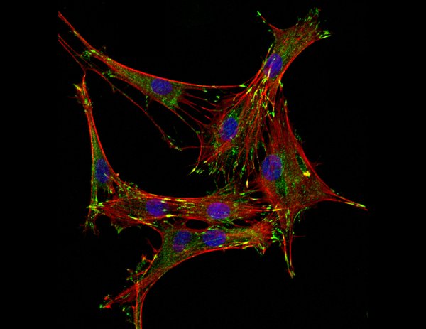 Stem cells interacting with the material it is grown on with the interaction highlighted in green, cell nuclei in blue, and cytoskeleton in red. Taken by Anouk Killaars.