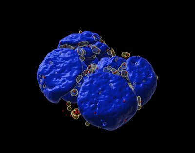 Anthony Khong (Parker Lab) - Nikon A1R Laser Scanning Confocal. How cells adapt to stress remains a major outstanding question in biology. One way in which cells respond is by assembling stress granules. Stress granules can accumulate certain mRNAs, a key biomolecule that underlie gene expression, but how specific mRNAs accumulate in stress granules is unclear. Unfolding this mystery could lead to numerous therapeutic treatments for granule-related diseases such as amyotrophic lateral sclerosis (ALS). In this image, stressed mouse embryonic stem cells were stained with a nucleus marker (blue), a stress granule marker (yellow), and a specific mRNA molecule (red).
