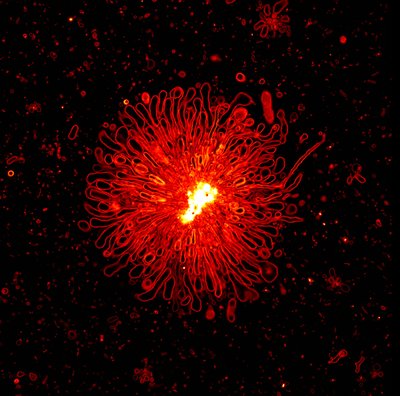 Dani Konetski (Bowman Lab) - Nikon A1R. A vesicle is fundamentally similar to a cell membrane and can be created synthetically, making this an ideal model structure for laboratory research. Because of its similarity to a cell membrane, vesicles have numerous applications including drug delivery and membrane studies. In this image, an aggregation of light-induced vesicles is shown.