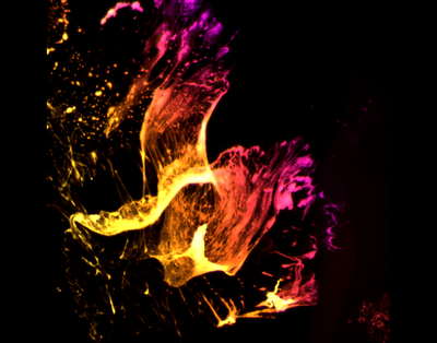 Evan Leach and Erin Richards (Palmer Lab) - Nikon A1R Laser Scanning Confocal. Special surface coatings are often applied to glass to help cells adhere and remain healthy. This image shows a region where that surface coating is uneven, with the purple/pink colors being closest to the glass and yellow being further above the glass. While gorgeous, these types of defects may obstruct the view of the sample during imaging, emphasizing the importance of careful sample preparation.