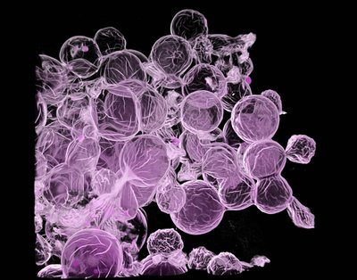 Matthew D. Davidson, Bradley Taha, Jason Burdick (Burdick Lab) - Nikon AXR Laser Scanning Confocal. Microgels are an important class of biomaterials used for promoting tissue regeneration. However, they often lack topographical cues to elicit an appropriate response from cells. Engineering the surface (white) of the microgels (purple) with varying characteristics can guide cell migration to enhance tissue repair.