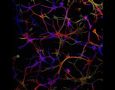 Monica L. Ohnsorg (Anseth lab) - Nikon AXR Laser Scanning Confocal. Osteocytes make up 90% of all the cells in our bones. Like the neurons in our brains, these cells can form integrated networks to communicate with each other, even through hard, calcified bone. This capability is a key component of bone health. Here, you can observe the osteocytes as they developed this network in 3D, with the reds closer to the viewer than the blues.