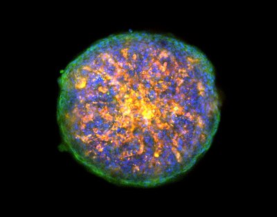 Sven Arnar Saemundsson (Cha lab and Goodwin lab) - Nikon AXR Laser Scanning Confocal. The lack of oxygen (“hypoxia”) within tumors can have disastrous consequences. Tumor hypoxia promotes malignant behavior of cancer cells, including proliferation and migration, and it enhances resistance to treatments such as immunotherapy, chemotherapy, and radiotherapy. Here we are investigating how the distribution of different cell types (blue and red) impacts the levels of hypoxia (green) found within this tumor-mimicking model.