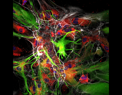 Andrew Lombardi (Hoeffer Lab) - Nikon AXR Laser Scanning Confocal. Cell painting is a technique used to highlight different compartments of cells, which can be used to assess how the physical structure of specific cells changes in response to various treatments. Understanding the impact a treatment has on cell form can lead to the discovery of new drugs. Here, the cell cytoplasm (red), F-actin structural support protein (white), nucleus (blue), and a specific brain astrocyte marker (green) are all shown, highlighting the complex multicellular environment.