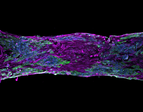 Cardiac muscle with a fibrotic scar (area with only magenta) with fibroblasts (magenta), cardiomyocytes (green), and cell nuclei (blue). Taken by Mackenzie Obenreder.