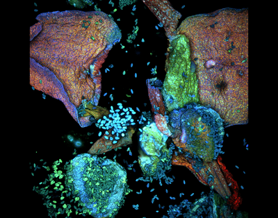 Azucena Valentina Flores Young (Student, MCDB 4312) - Nikon AXR Laser Scanning Confocal. Fluorescence microscopy is a valuable scientific tool that enables us to see what is otherwise imperceivable to the human eye. Even something as simple as the common garden flower can, under the right light, appear as if it is from another world! We can leverage this exciting visualization to motivate the next generation of scientists and complement what they are learning in their academic studies.