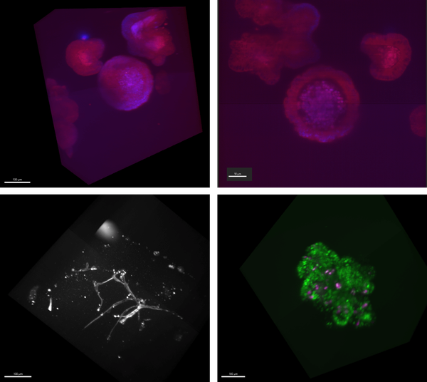 Bruker-organoids
