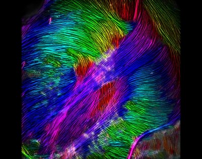 Nathaniel Skillin (Anseth and White Labs) - Nikon Eclipse Ti2 Crest X-light. The interactions between cardiac muscle cells and the stiffness of the supporting matrix can drive the formation of unwanted stress fibers as the cell spreads. The alignment of these fibers can appear even more pronounced when the fibers are false-colored according to their directional orientation. Understanding these cell-matrix interactions is crucial when developing new synthetic polymers for biomedical applications.