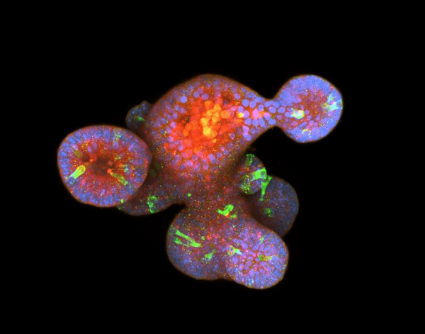 Intestinal organoid with Paneth cells (green), cell nuclei (blue), and key signaling proteins (red). Taken by Nolan Petrich.