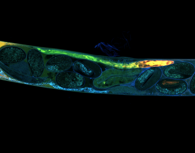 Camdyn Rakow (Mendoza Lab) - Nikon NSPARC Laser Scanning Confocal. Caenorhabditis elegans are transparent nematodes found in soil. These organisms are frequently used as model organisms and were the first multicellular organism to have its whole genome sequenced, and the first to have its neuronal wiring diagram completed. Here, we can see the individual developing embryos as they progress down the reproductive pathway.