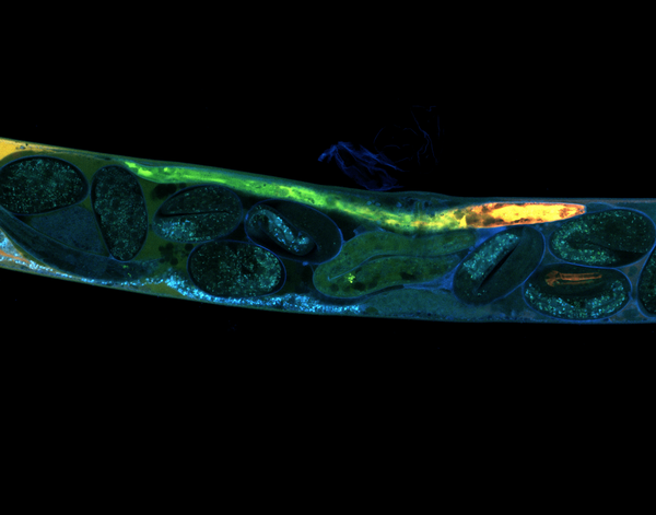 Worm embryos that develop as they move down the reproductive pathway. Taken by Camdyn Rakow.