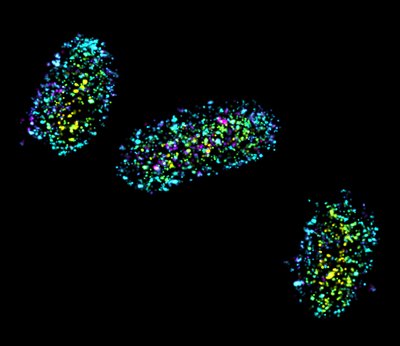 Stephen Upton (Sousa Lab) and Warren Colomb (DoubleHelix Optics) - Nikon N-STORM with Double Helix Optics SPINDLE®. Imaging the subcellular components of bacteria is incredibly challenging due to the physical limitations of light microscopy to clearly resolve extremely small objects. Recent advances in microscopy provide pathways to overcome these limitations, greatly increasing the level of detail that can be observed. Here, the outer membranes of three E. coli bacteria have been fluorescently labeled, with each dot representing the location of a single fluorescent molecule. Additionally, these bacteria were observed in 3D (warm tones are closer to the observer while cool tones are further).