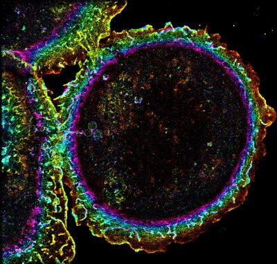 Scientists and Engineers at DoubleHelix Optics, LLC - Nikon N-STORM with Double Helix Optics SPINDLE®. The protein actin organizes into filaments that are essential for maintaining the shape of cells. Actin filaments also play a crucial role in cancer progression. Here, the actin structure in breast cancer cells is observed using Double Helix 3D imaging, with the color corresponding to different heights in the cell (purple is closest to the observer, and red is furthest). Understanding actin structure and organization helps provide researchers with insights towards discovering viable anti-cancer treatments.