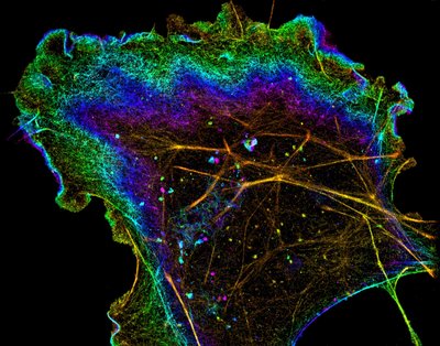 Scientists and Engineers at DoubleHelix Optics - Nikon N-STORM. Traditional microscopes often are unable to resolve the truly fine structures in our cells. This puts a limit onto what researchers can observe and the areas of study that can be pursued. Recently, advances in optical microscopy technologies have improved upon this visual limit by nearly ten-fold. Such progress is allowing investigators to achieve new insights into subcellular structure and function.