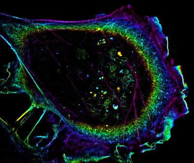 Katie Heiser (DoubleHelix Optics) - Nikon N-STORM. This three-dimensional Double Helix super-resolution image shows the actin cytoskeleton of an individual African green monkey kidney cell. Here, the depth of the cell is color coded, with objects in purple at the bottom of the cell while those in red at the top. Thick actin stress fibers are visible along with a network of thin actin filaments. These fibers and filaments enable the cell to signal to other cells, adhere to surfaces, and divide.