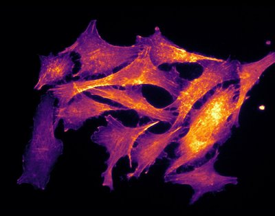 Suzannah Miller (Ahn Lab) - Olympus Widefield. Actin, a common protein found in cells, often forms microfilaments within cells. These filaments play a major role in cellular function such as cell shape and migration, and they can be an indicator of overall cell health. Here, the actin filaments have been fluorescently labeled, with the resulting image false-colored using a heat map. Here, warmer colors reflect the presence of actin stress fibers, which is indicative of poor cellular health.