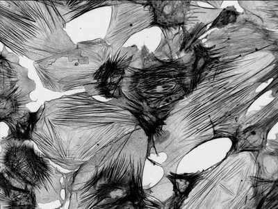 Tova Ceccato (Anseth and Leinwand Labs) - PerkinElmer Operetta. The human heart is made up of multiple cell types, of which fibroblasts are the most numerous. Cardiac fibroblast cells play several roles including ensuring the proper functioning of our heart as well as helping in wound repair from heart attacks and hypertension. An important characteristic of cardiac fibroblasts is the presence of stress fibers. We can regulate the development of stress fibers by growing the cells on specific surfaces, allowing us a reliable platform by which to carry out our studies. Above, this process is demonstrated with the successful formation of numerous stress fibers (black lines) in multiple cardiac fibroblasts (grey).