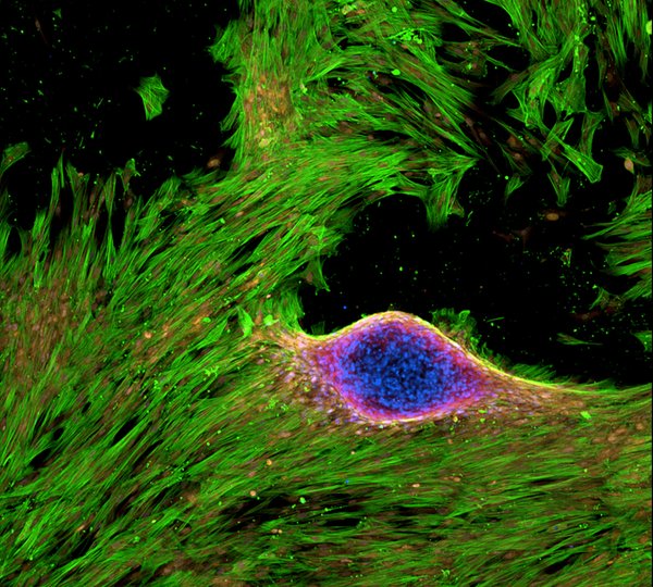 Heart valve muscle cells. Actin cytoskeleton (green), cell membranes (yellow), bone-related proteins (red), and cell nuclei (blue). Taken by Megan E. Schroeder.