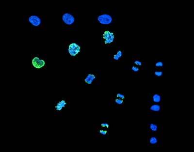 Sam Holtzen (Palmer lab) - PerkinElmer Opera Phenix. Cell division is a complicated but essential process for life involving the correct transfer of DNA from the mother cell to the daughter cells. Understanding this process gives critical insight into fetal development, cancer, and inherited diseases. Here, investigators monitored the phases of cell division (blue) while tracking modified DNA (green).