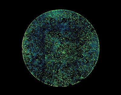 Lotte Watts/Tim Hoffman (Spencer Lab) - PerkinElmer Opera Phenix. It is becoming increasingly important to observe numerous cells in order to achieve appropriate statistical power. Here, hundreds of mammary epithelial cells were imaged after weeks of continuous treatment with a promising new drug that prevents tumor growth. By observing specific proteins (blue-green) in the nucleus, researchers can track the progression of cells over time. Experiments like this can inform investigators whether cells remain sensitive to the drug or whether they become resistant over time, a key metric in delivering successful therapies in the clinic.