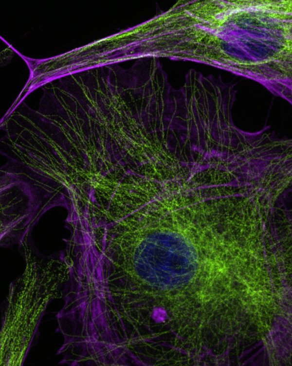Bovine pulmonary artery cells at 100x magnification. Blue - cell nuclei, Red - actin filaments, Magenta - microtubules. Taken by Jian Wei Tay.