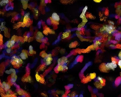 Doug Peters (Garcea Lab) - Nikon SDC. Mouse fibroblasts expressing a fluorescent protein were infected with mouse polyomavirus and imaged for several hours. Each frame of the resulting time-course was assigned a color, where “cooler” colors represent early frames and “warmer” colors represent later frames. This allows you to see how these living cells move as the time-course progresses and how the fluorescent protein re-organizes into punctate viral replication centers.