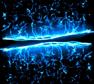 Megan Schroeder & Andrea Gonzalez Rodriguez (Anseth Lab) - Nikon SDC. Understanding why fibrosis occurs is essential for creating drug therapies. To this end, researchers study specific heart valve cells called fibroblasts that are grown in 3D supportive matrix that mimic aspects of native tissue to probe cell response in disease-like scenarios. Here, we see fibroblasts within a 3D gel. Various tones of blue mark the individual cell nuclei and their cytoskeletal components.