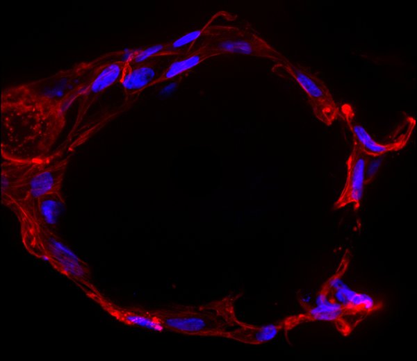 Cells growing around a spherical hydrogel. Cell nuclei (blue) and cytoplasm (red). Taken by Varsha Rao.
