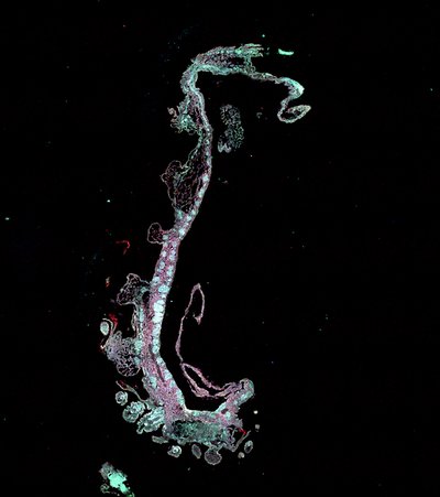 Daniel Zarate, Samantha Bonelli, and Jingchun Li (Li Lab) - Nikon Spinning Disk Confocal. The southern giant clam, Tridacna derasa, is found in the tropical waters of Guam. In this species, the outermost layer of tissue, the mantle, is used to harbor tiny algae creating a symbiotic relationship between the two wherein the clam provides a safe environment for algae growth and, in return, the algae can act as a significant energy source for the clam. We are trying to unravel the mechanisms that help maintain this relationship in order to provide insights to other symbiotic systems such as corals. Observing the native autofluorescence of a cross-section of the clam’s mantle provides us structural insight to the tissue. In this image, different compartments of the mantle appear as different colors.