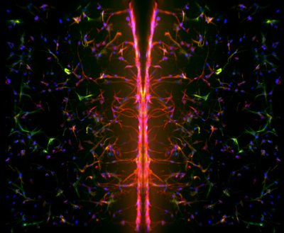 Megan Schroeder and Andrea Gonzalez Rodriguez (Anseth Lab) - Nikon Spinning Disk Confocal. Fibroblasts are cells that produce the structural framework for the tissues found in our bodies. Observing how these cells respond to diseases helps researchers understand why fibrosis, for example, in heart disease, might occur. By combining fibroblasts with engineered growth matrices that mimic aspects of their native tissue, investigators gain insights into disease development. Individual cell nuclei (Blue) and cytoskeletal components (Green and Red) are shown.