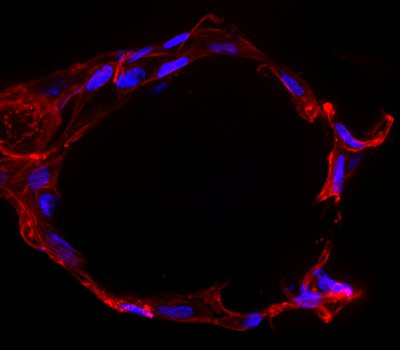 Varsha Rao (Anseth Lab) - Nikon Spinning Disk Confocal. To help mimic conditions found within the body, scientists often grow their cells in 3D environments called hydrogels. Here, the hydrogels were formed into small spheres to promote intercellular interactions more consistent with the native tissue compared to growing them in a flat dish. The cells in this image have wrapped themselves around a single microgel (the nuclei are in blue, and the cytoplasm is in red).